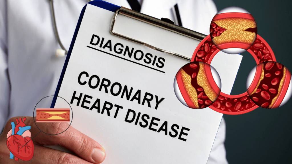 Coronary Artery Disease Symptoms, Causes, and Treatment