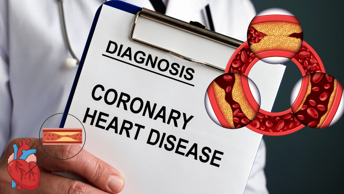 Coronary Artery Disease Symptoms, Causes, and Treatment