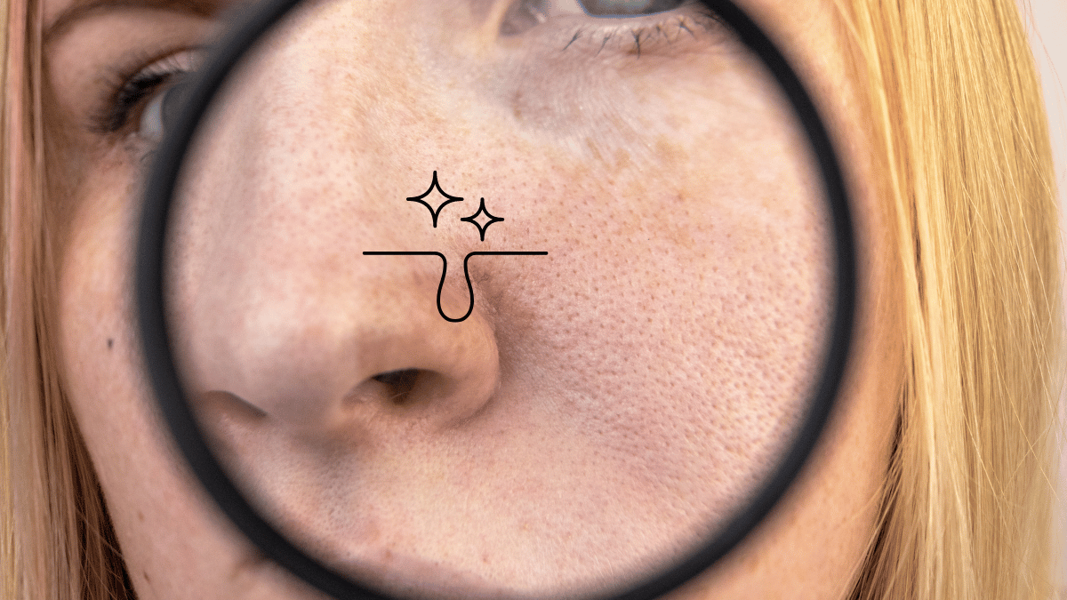 How to Reduce Pores On Nose