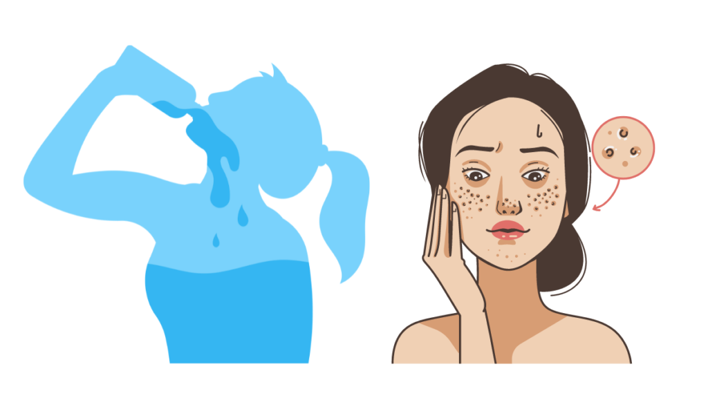 Moisturizing: Importance of Hydration